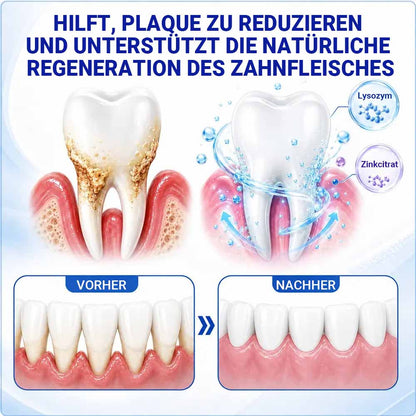 Pheromex® 🦷GumRevive Gel zur Parodontalpflege-up🍯