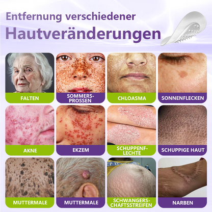 GFOUK® Lösliches Mikronadel-Pflaster zur Entfernung von Hautanhängseln auf Pflanzenbasis🏵️