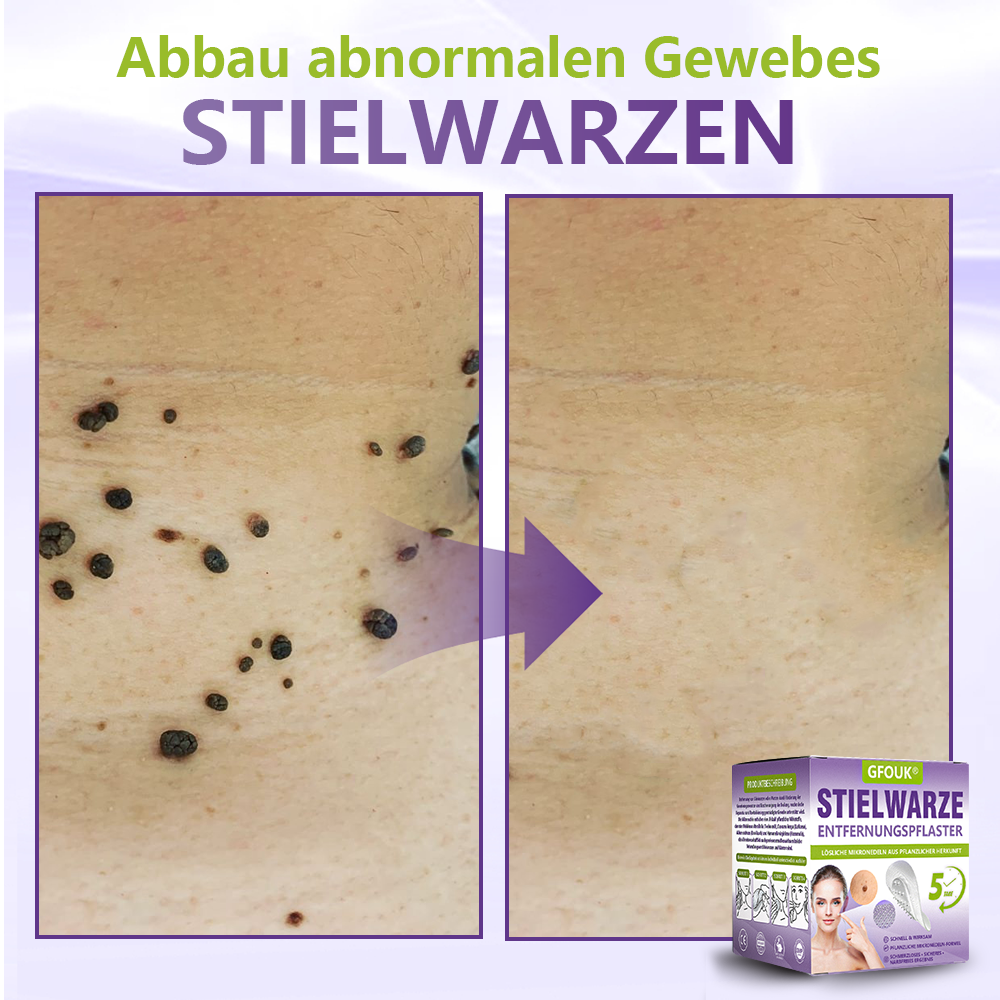 GFOUK® Lösliches Mikronadel-Pflaster zur Entfernung von Hautanhängseln auf Pflanzenbasis🏵️