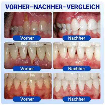 Pheromex® 🦷GumRevive Gel zur Parodontalpflege-up🍯
