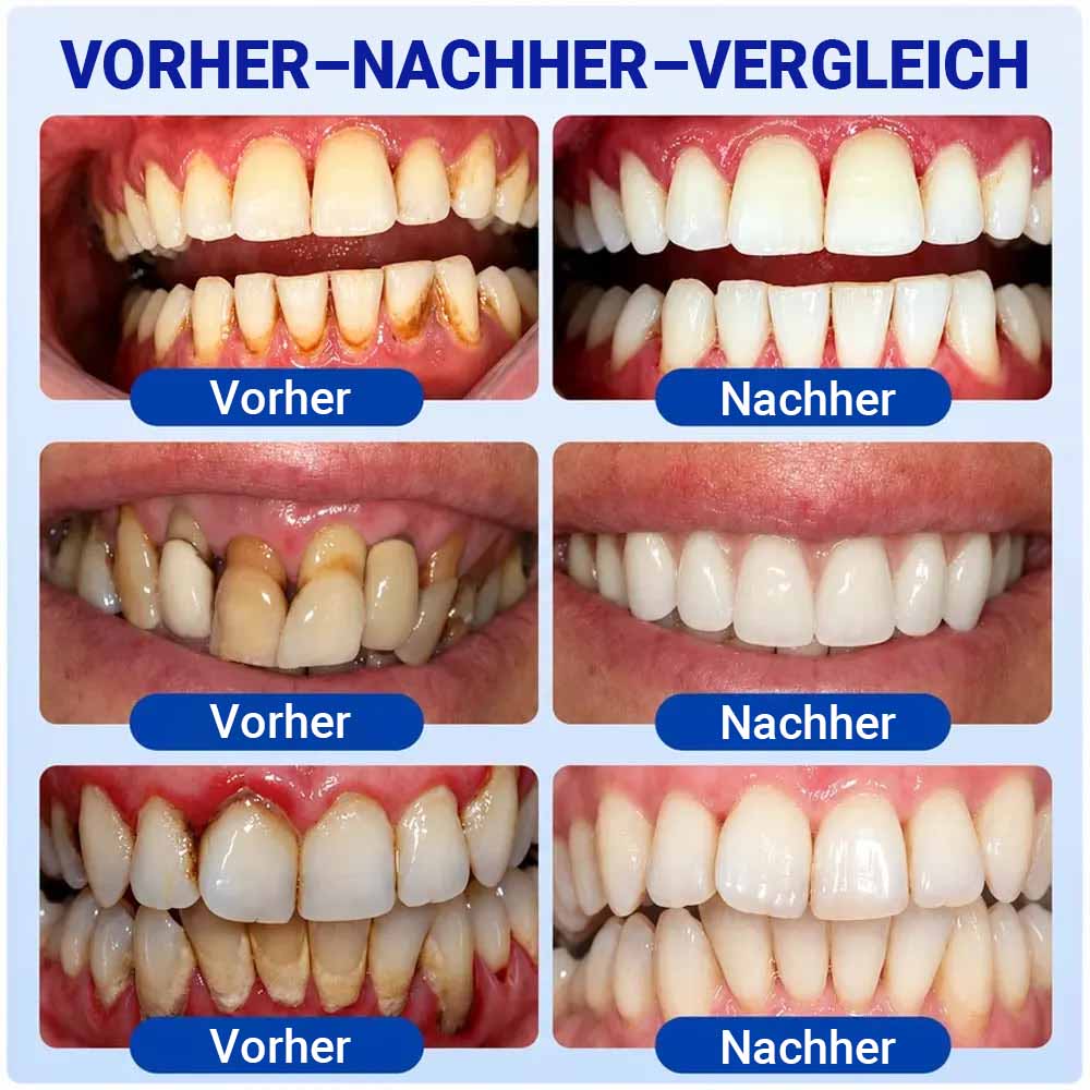 Pheromex® 🦷GumRevive Gel zur Parodontalpflege-up🍯