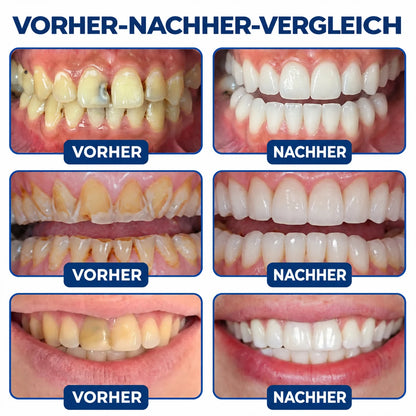 Dr.Fachmer® DentRestore Zahnreparatur- & Füllsystem🏆🏆
